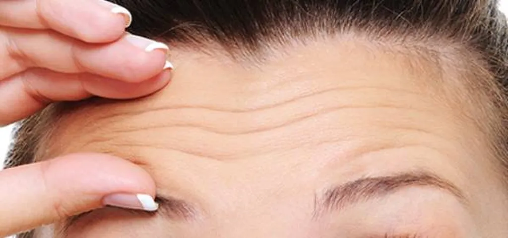 botox profhilo morpheus 