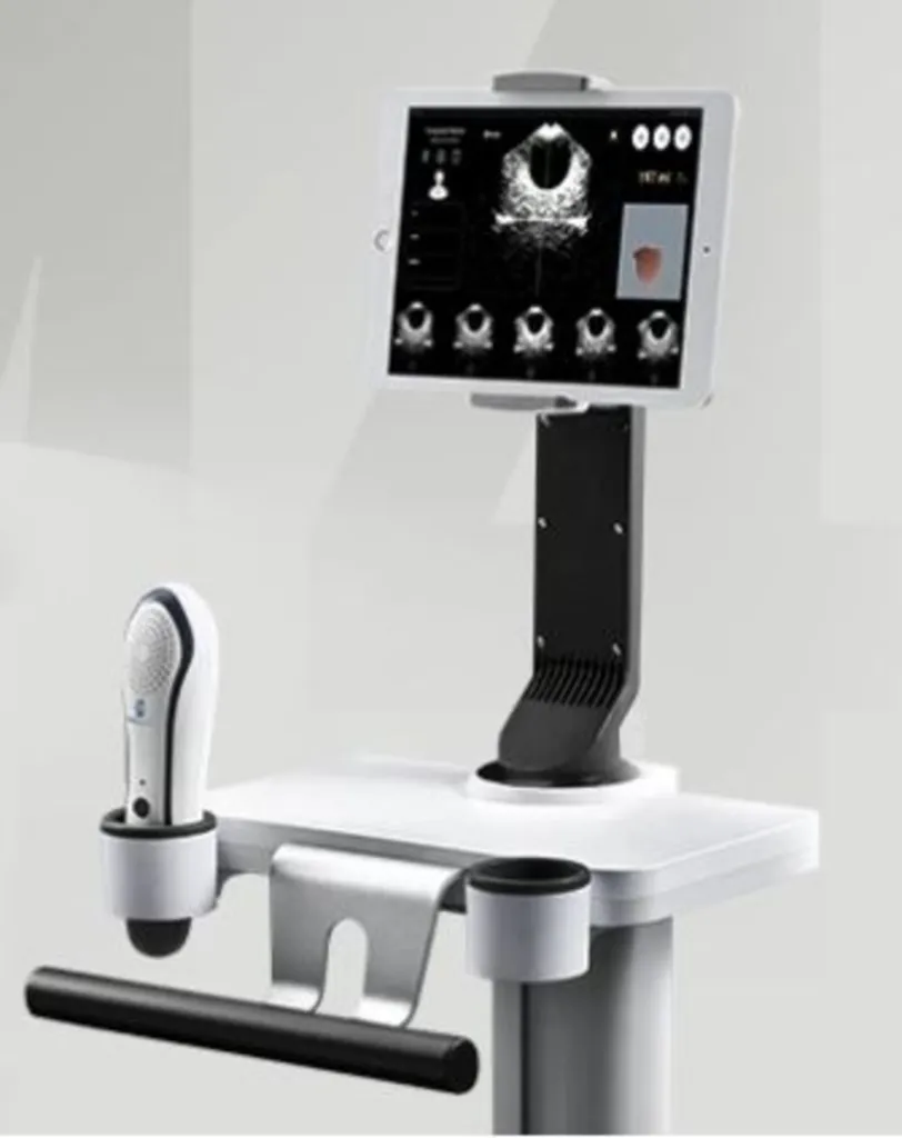 Scanner de vessie portable PeakSonic M4 3D – appareil ultrason 3D au chevet du patient affichant le volume vésical à Perpignan