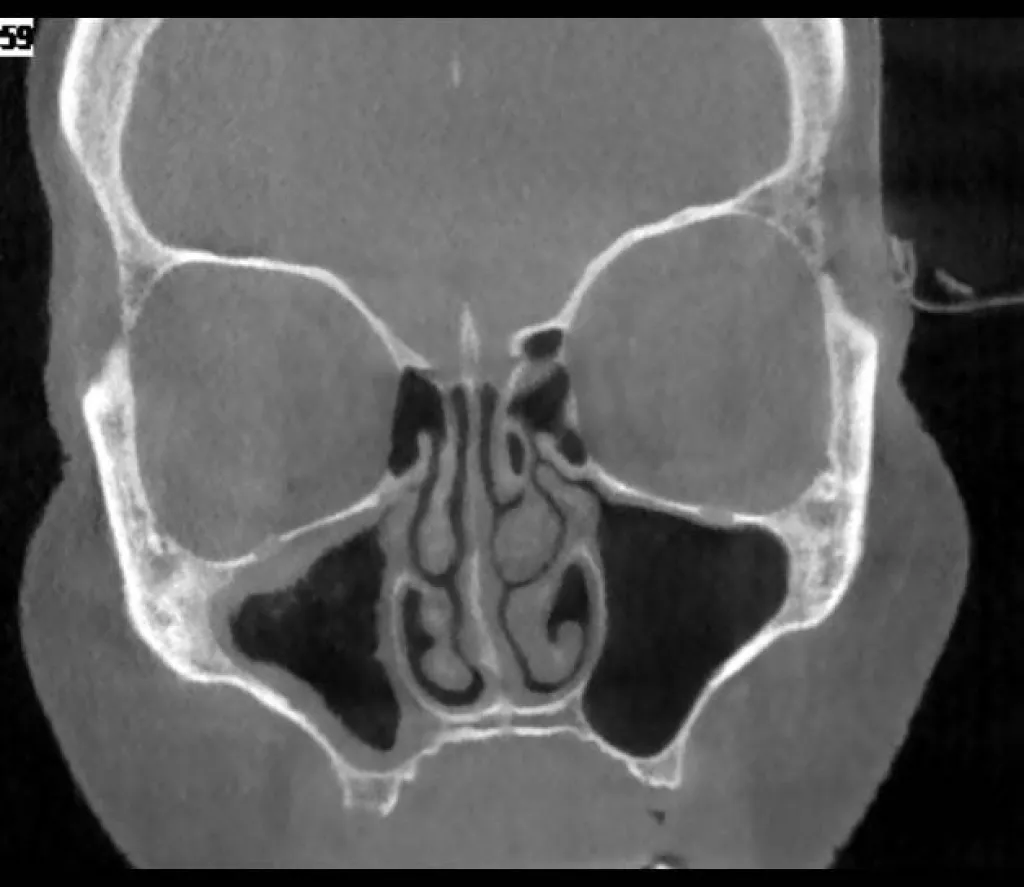 Faire un Cone Beam  CT sur Marseille