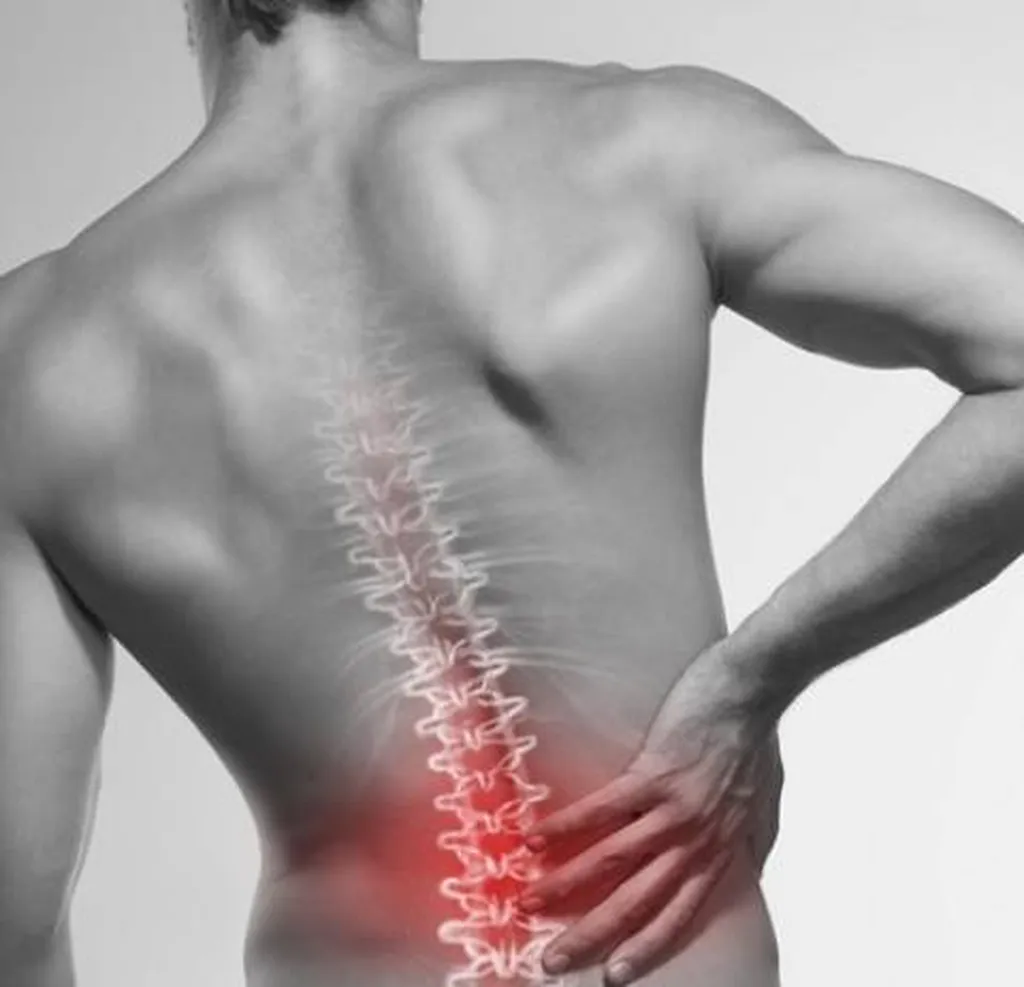 Sciatique et douleur lombaire traitée en ostéopathie à Lyon