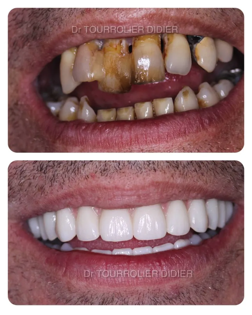 Notre zone d'activité pour ce serviceCabinet dentaire avec laboratoire de prothèse