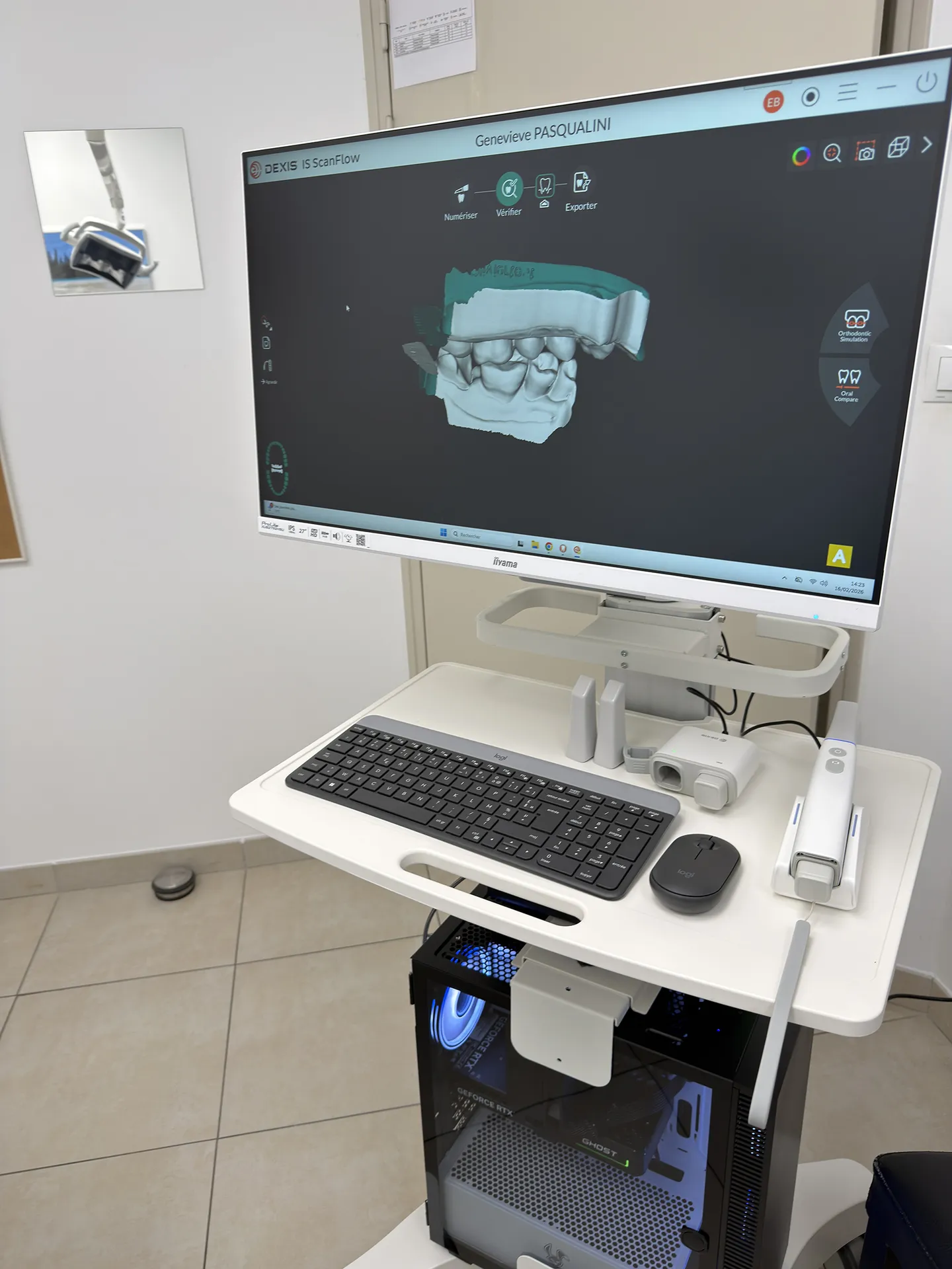 Installation caméra Dexis Imprevo sur un cart mobile