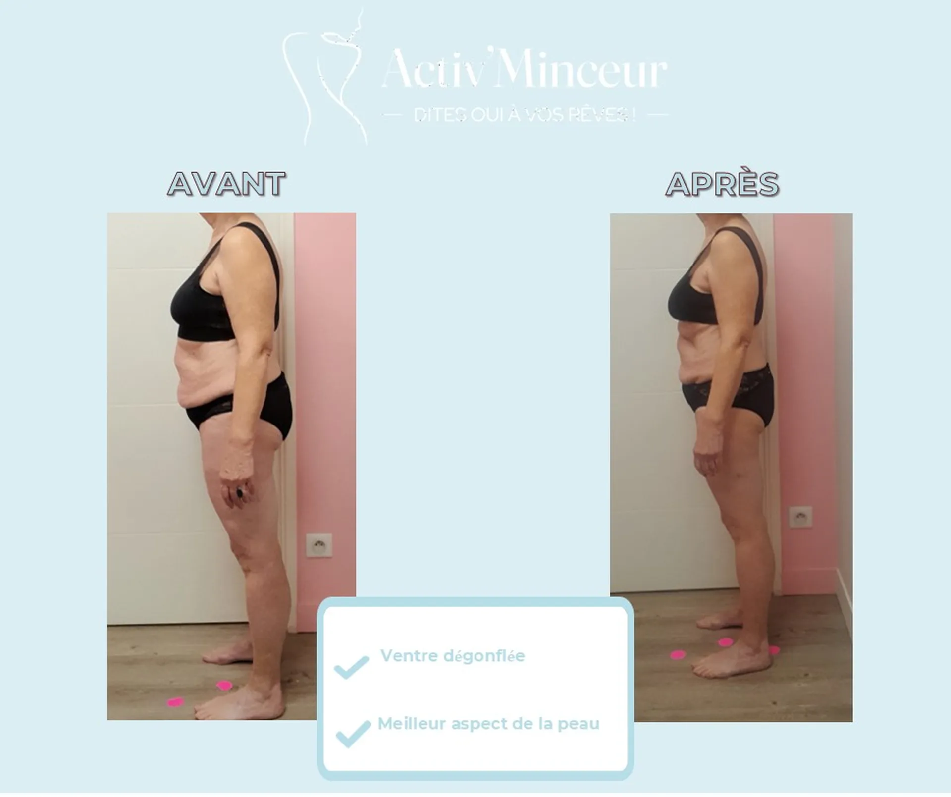 Bernadette -6 Kg -37cm en 9 mois 
