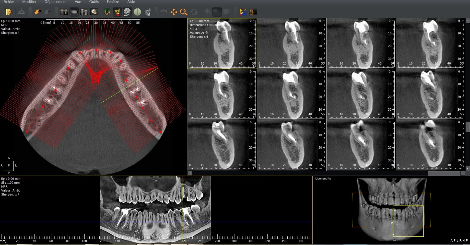 Logiciel CBCT LAQK027