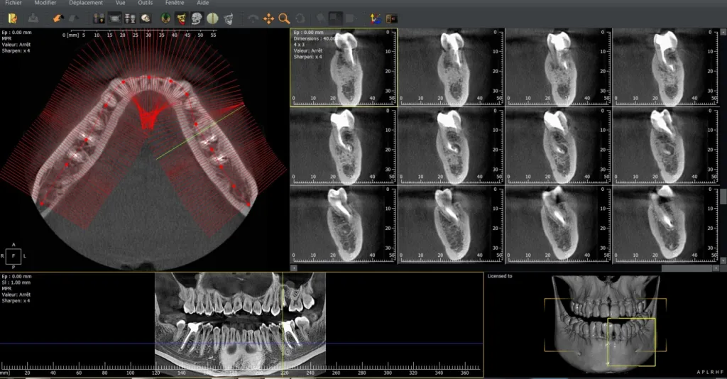 Logiciel CBCT LAQK027