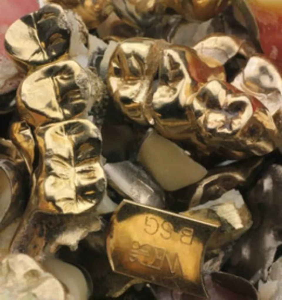 achat or dentaire marseille