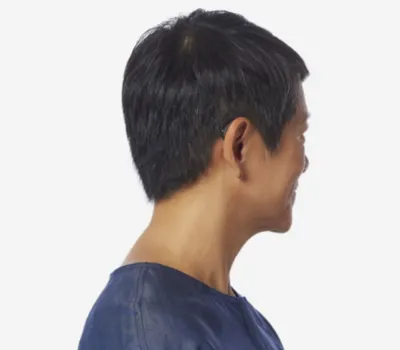 Appareil auditif discret, performant et rechargeable proche de Lyon: modèle mRIC R (rechargeable) Omega AI disponible dans un de nos centres