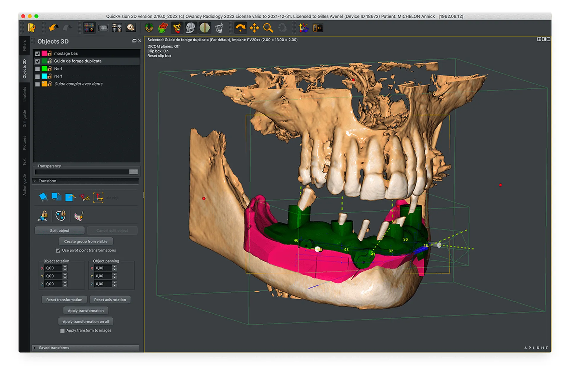 Owandy Quickvision 3D Meditec Dental à Marseille 13