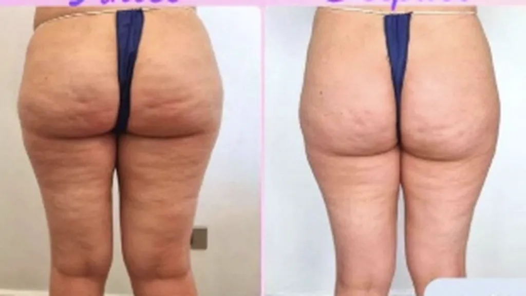 LE PRINTEMPS ARRIVE À GRANDS PAS