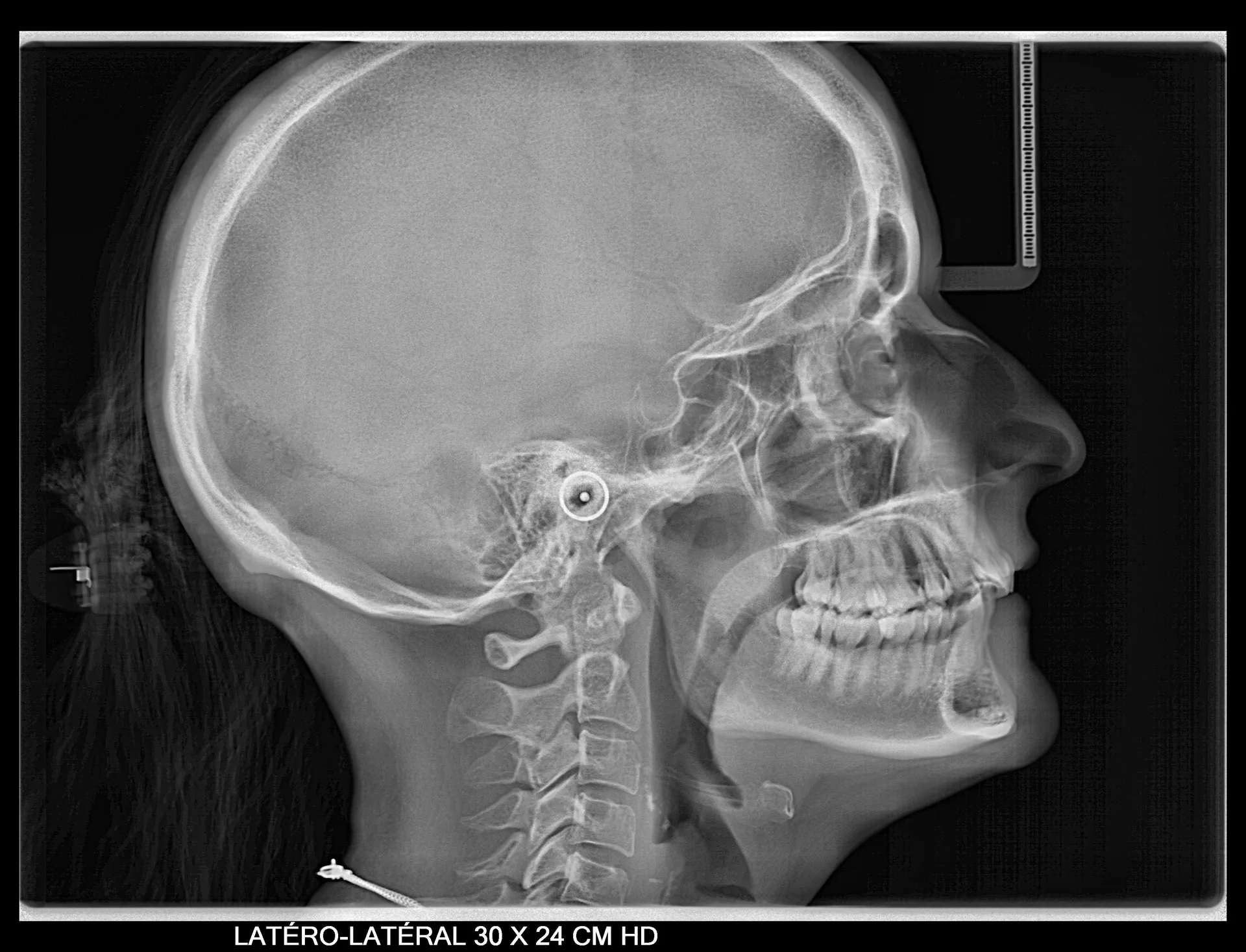 Owandy I-Max 3D XPRO Ceph Meditec Dental à Toulon 83