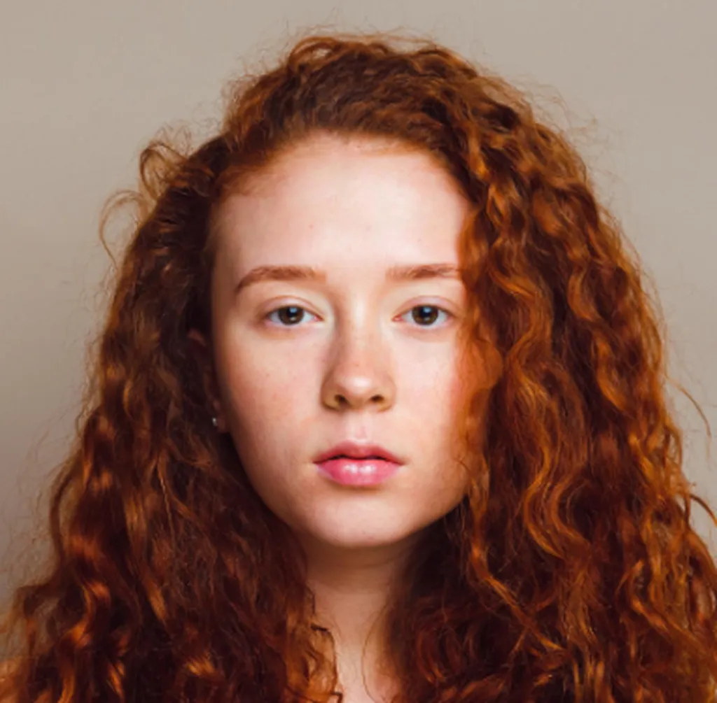 microneedling serum stimulation derme donner de l'eclat a la peau à paris 11