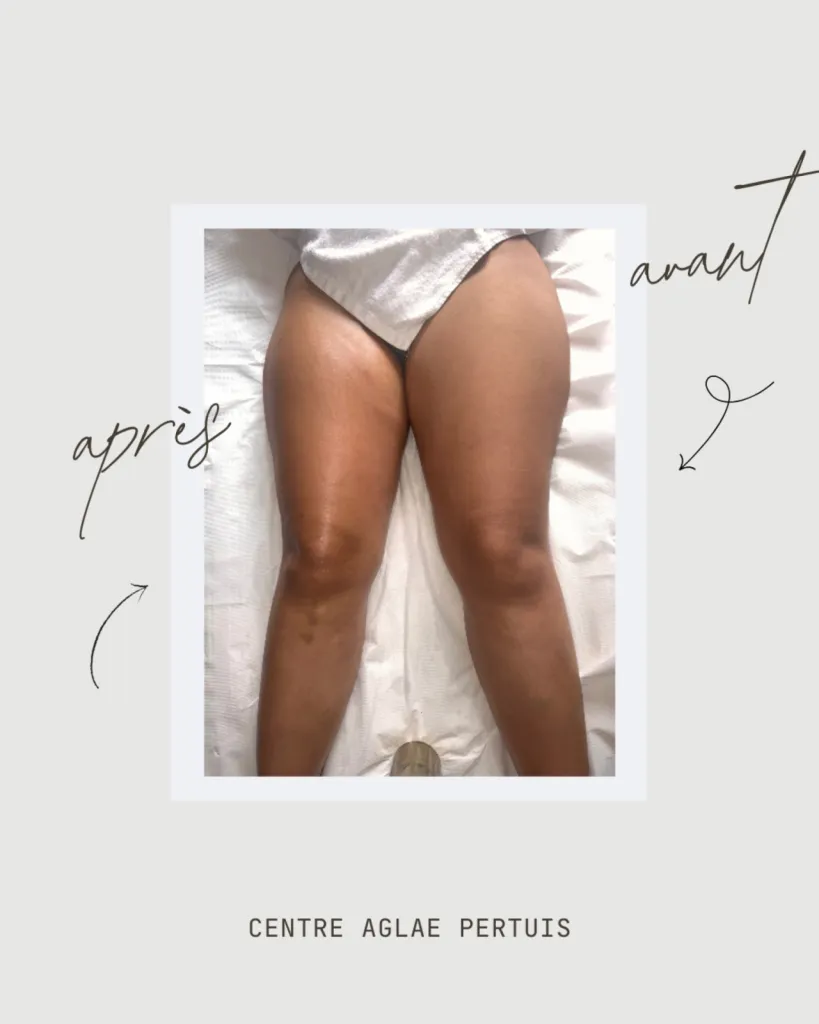 Le Pack Minceur Rentrée – Offre Spéciale au Centre Aglaé