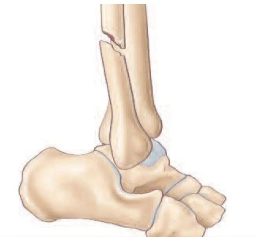 Docteur Julien Beldame, chirurgien orthopédiste, exclusif Pied Cheville, Fondateur de l'Institut de la Cheville et du Pied (ICP Amiens), consulte à l'ICP Paris