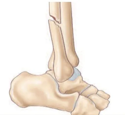 Docteur Julien Beldame, chirurgien orthopédiste, exclusif Pied Cheville, Fondateur de l'Institut de la Cheville et du Pied (ICP Amiens), consulte à l'ICP Paris