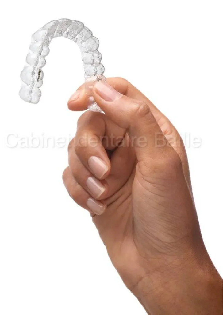 Orthodontie par Gouttière dentaire -Prix-Marseille