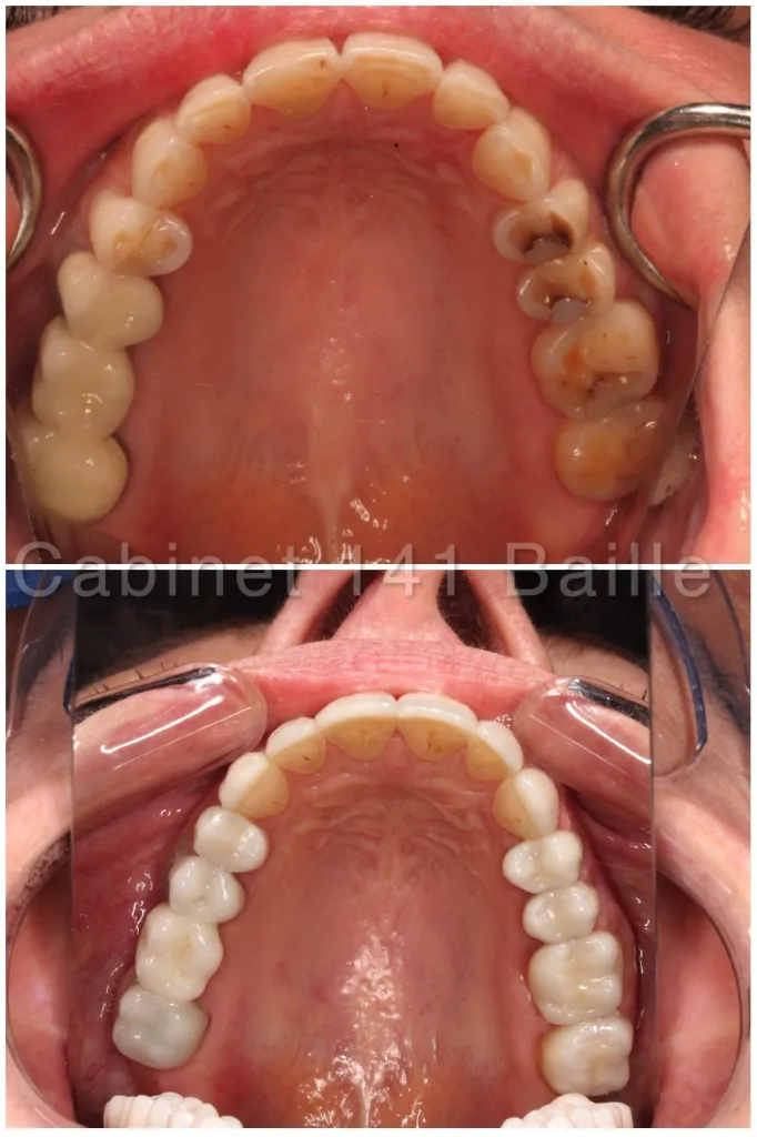 Notre zone d'activité pour ce serviceSpécialiste parodontie