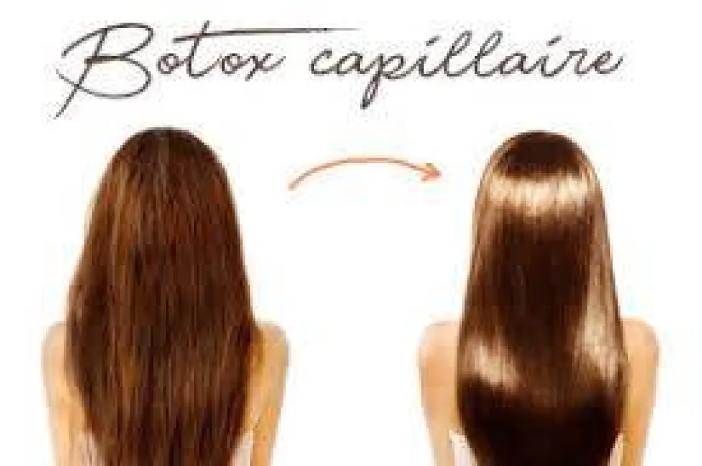 Le soin liftant au Botox Marseille avenue des Chartreux 13004