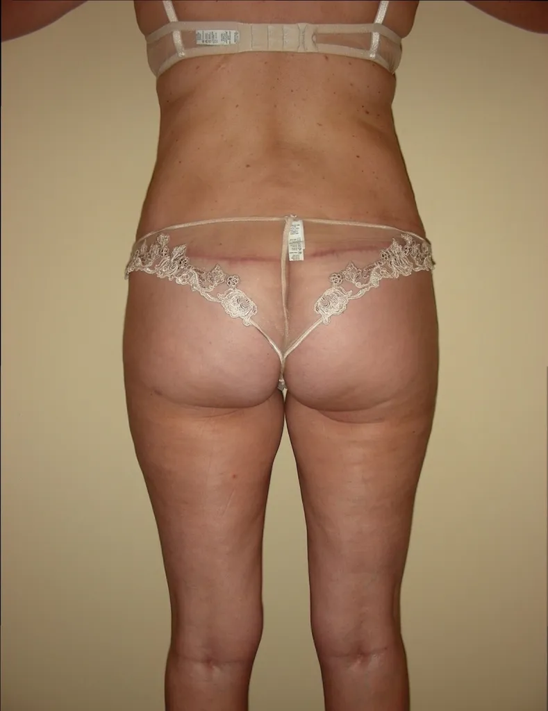 Chirurgien plastiqueà Toulouse en Haute-Garonne