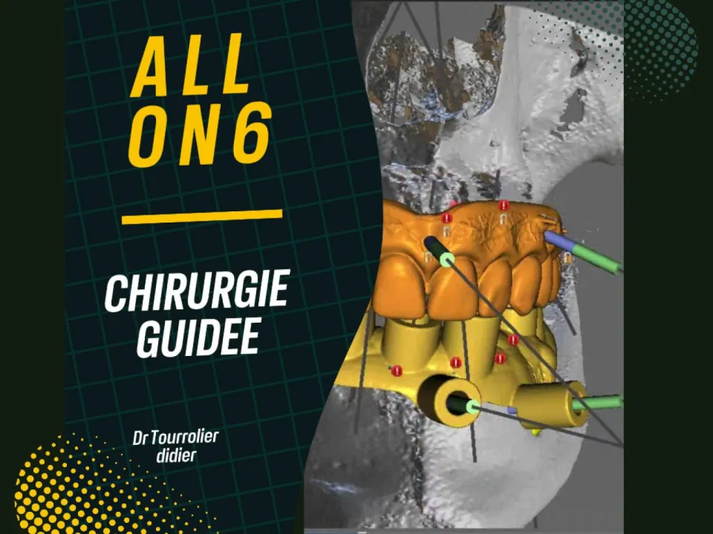 SPÉCIALISTE TECHNIQUE ALL ON 6  GUIDEE