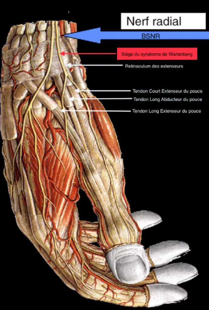 Echographie du Dome : Patient adressé pour impotence fonctionnelle du pouce avec fourmillement sur la face dorsale du 1er espace de la main et de la base du pouce.