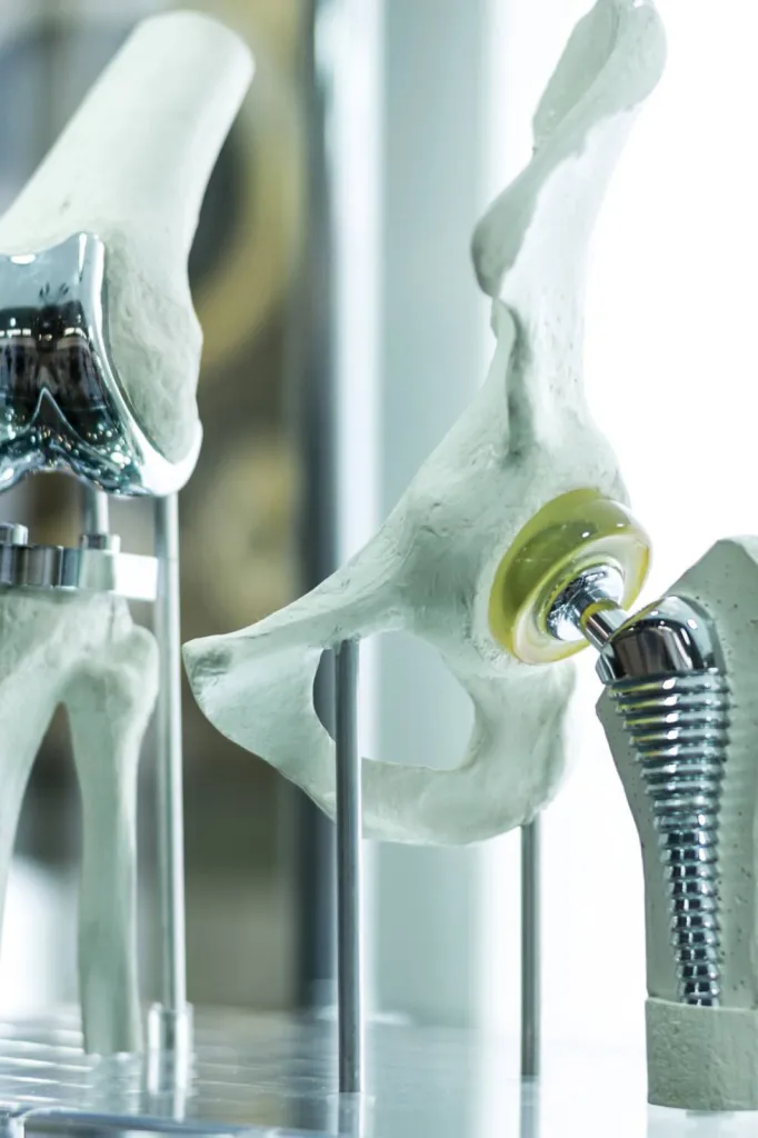 Traitement de prothèses de hanches en titane chez DBP Médical à LE BARP (33)