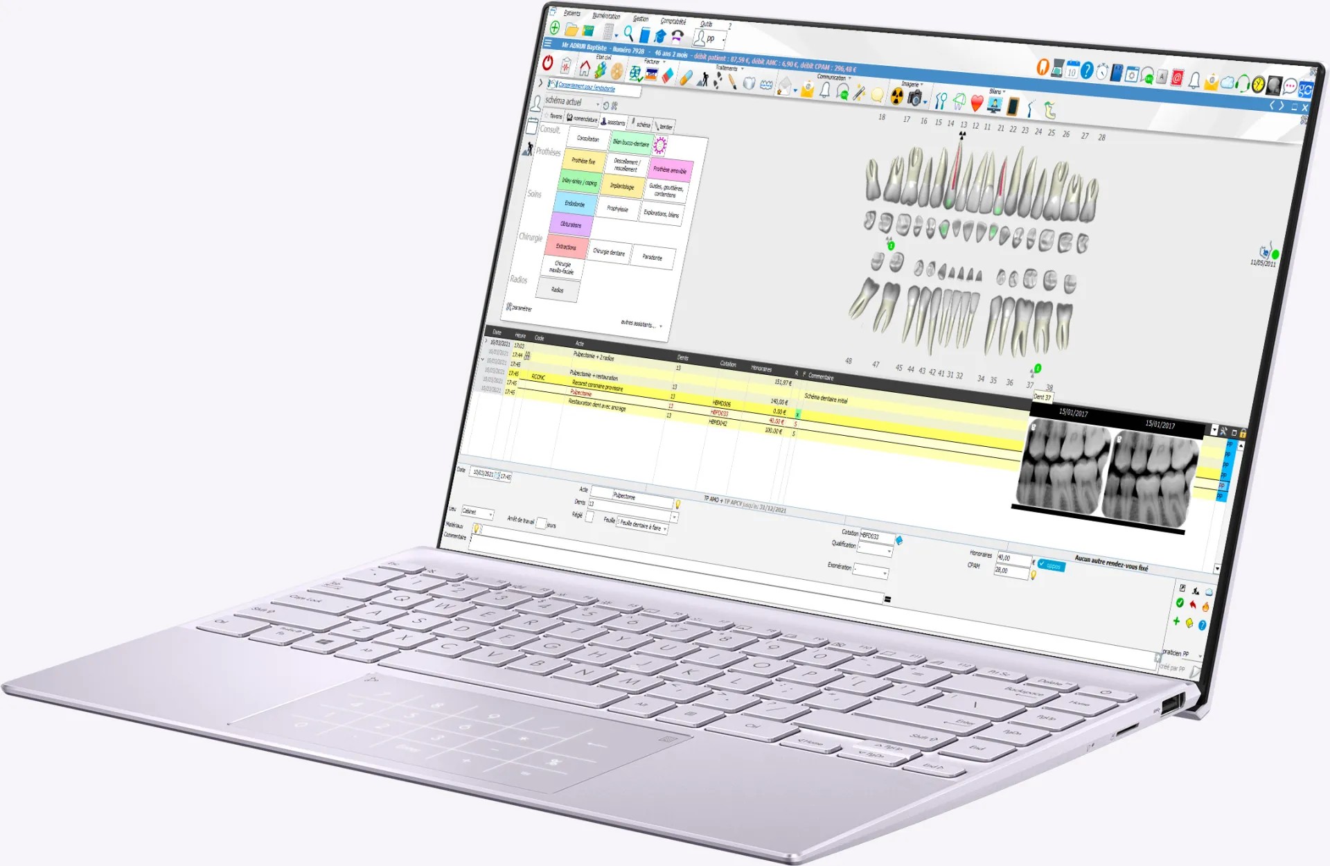 Formation LOGOSw Perfectionnement 2h Meditec Dental à Marseille 13