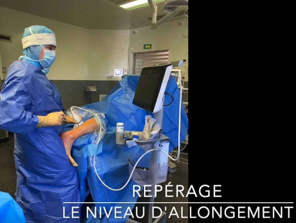 Dr Julien Beldame et la rétraction du tendon d'Achille, ICP Amiens