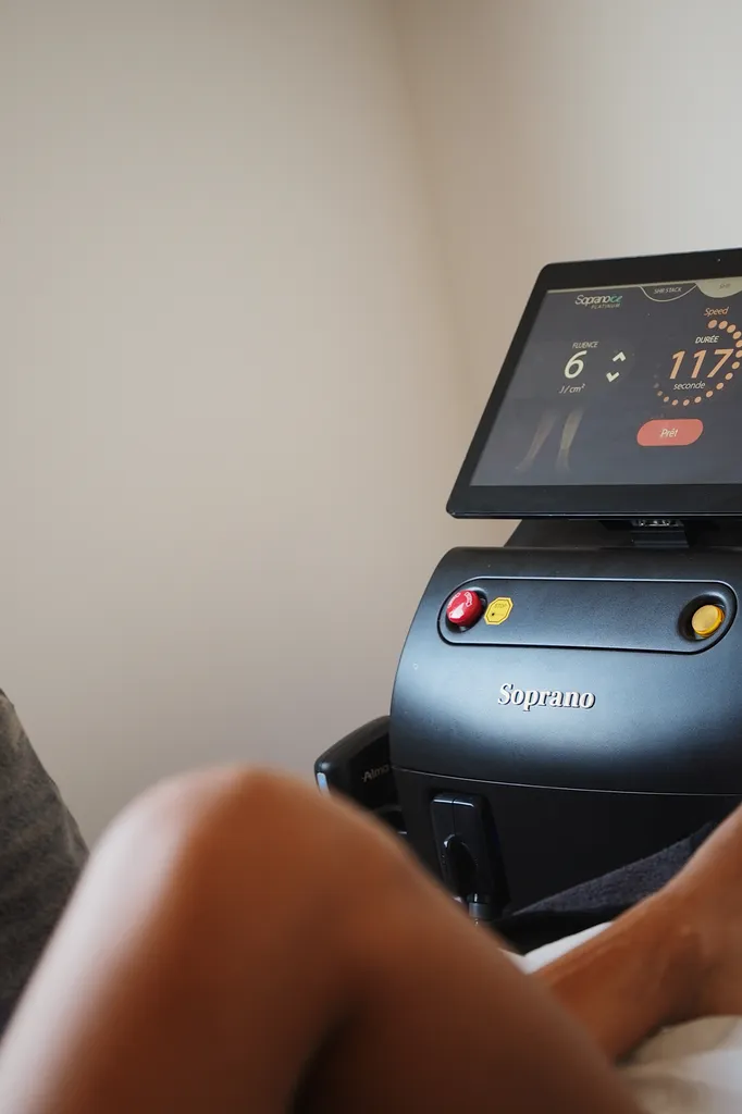 Toulouse epilation définitive