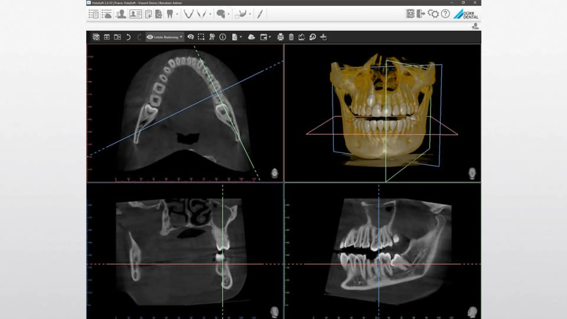 Durr Dental VistaVox 3D