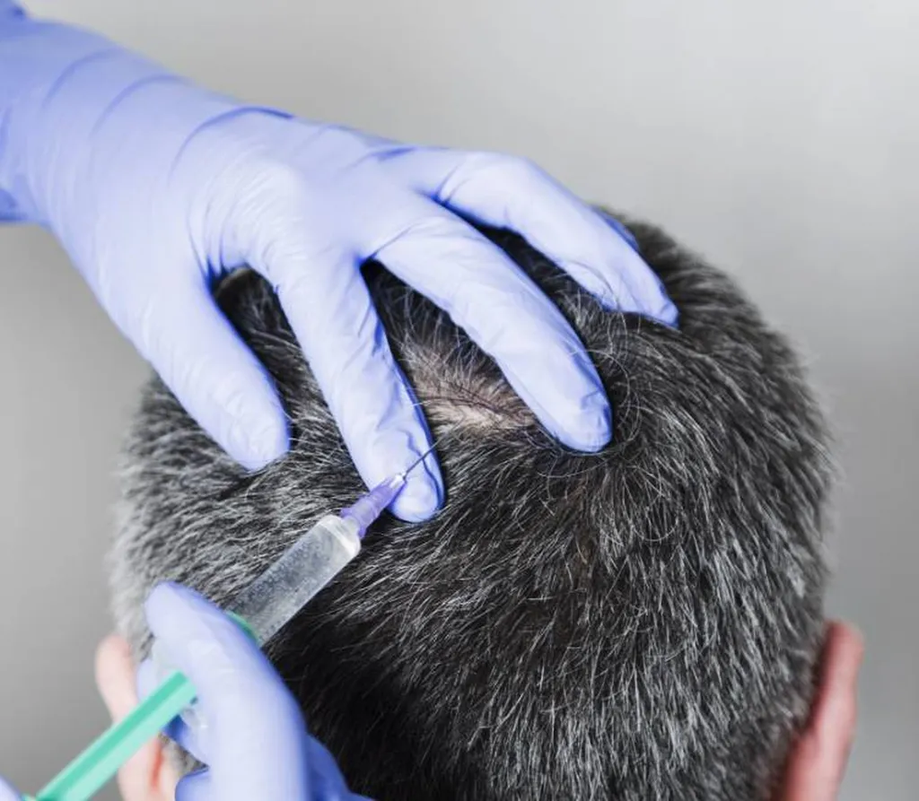 haircare AQskin polynucleotides laser Rigenera biotine