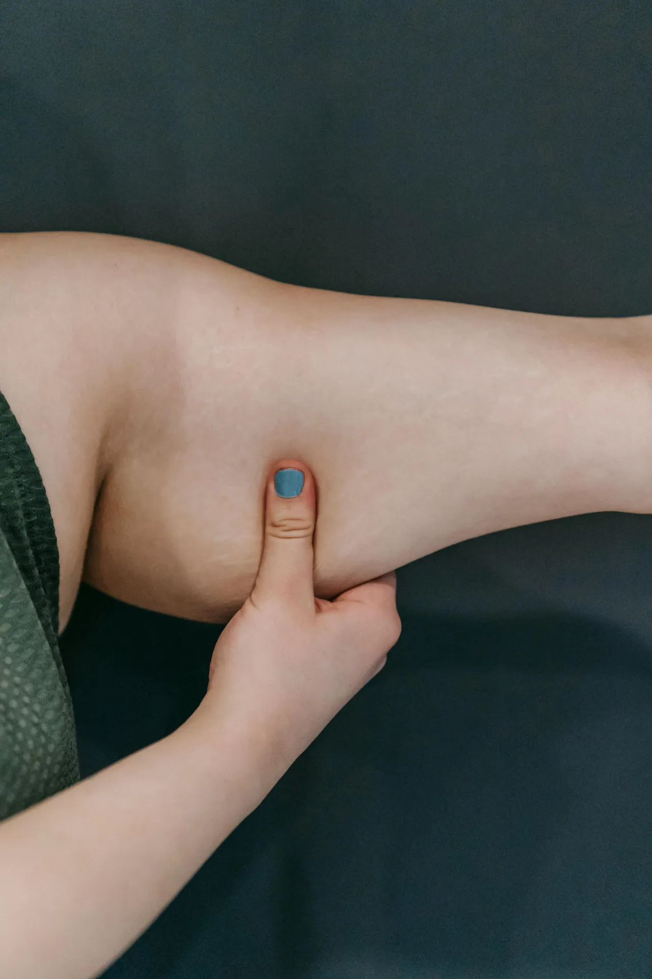 Bras relâchement cutané radiofréquence Indiba à Derma Sud proche de Toulouse