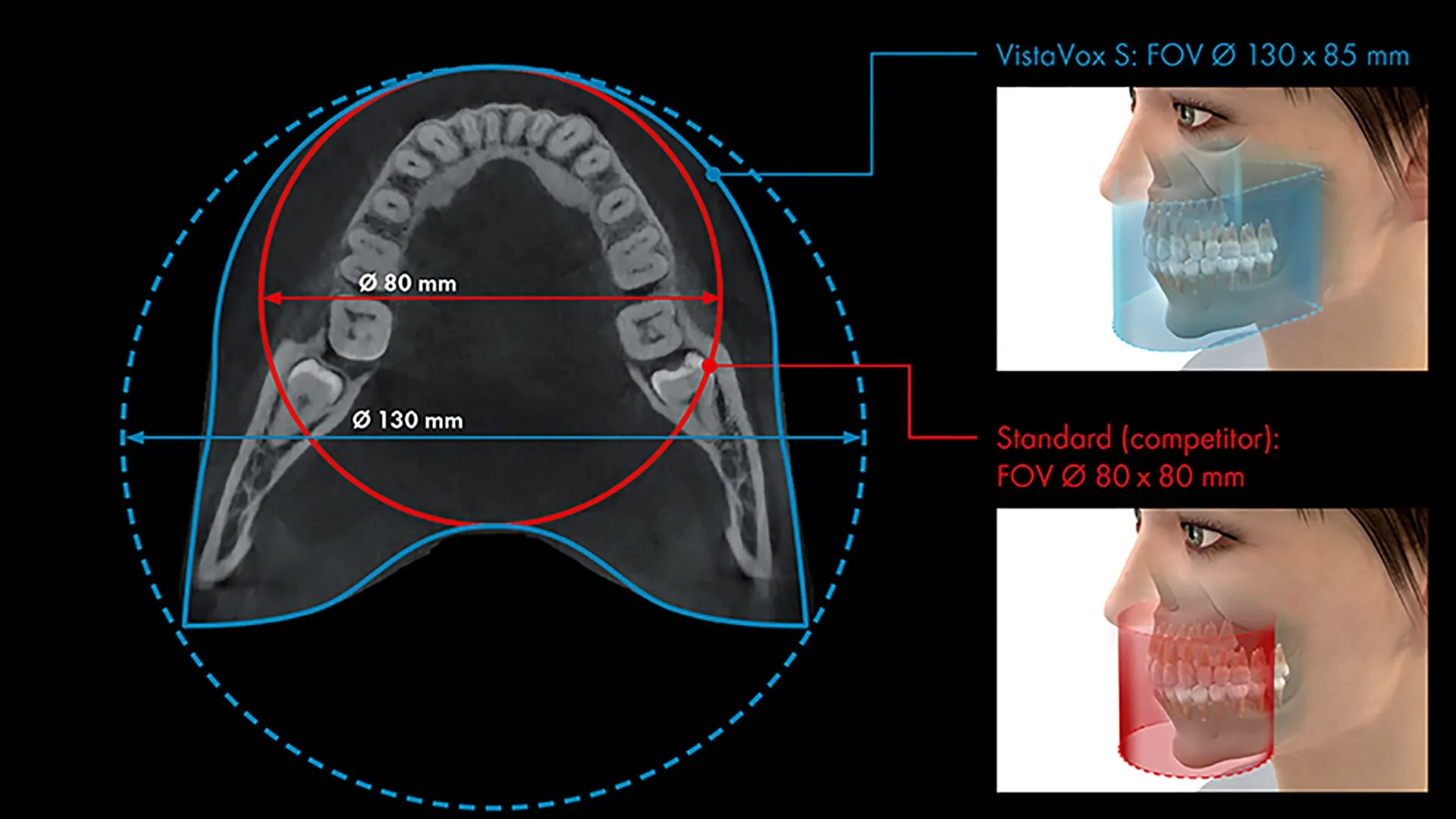 Le Cone Beam 3D, outil d’imagerie indispensable 