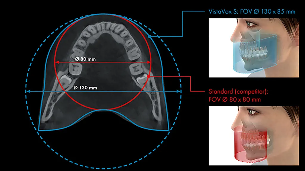 Le Cone Beam 3D, outil d’imagerie indispensable 