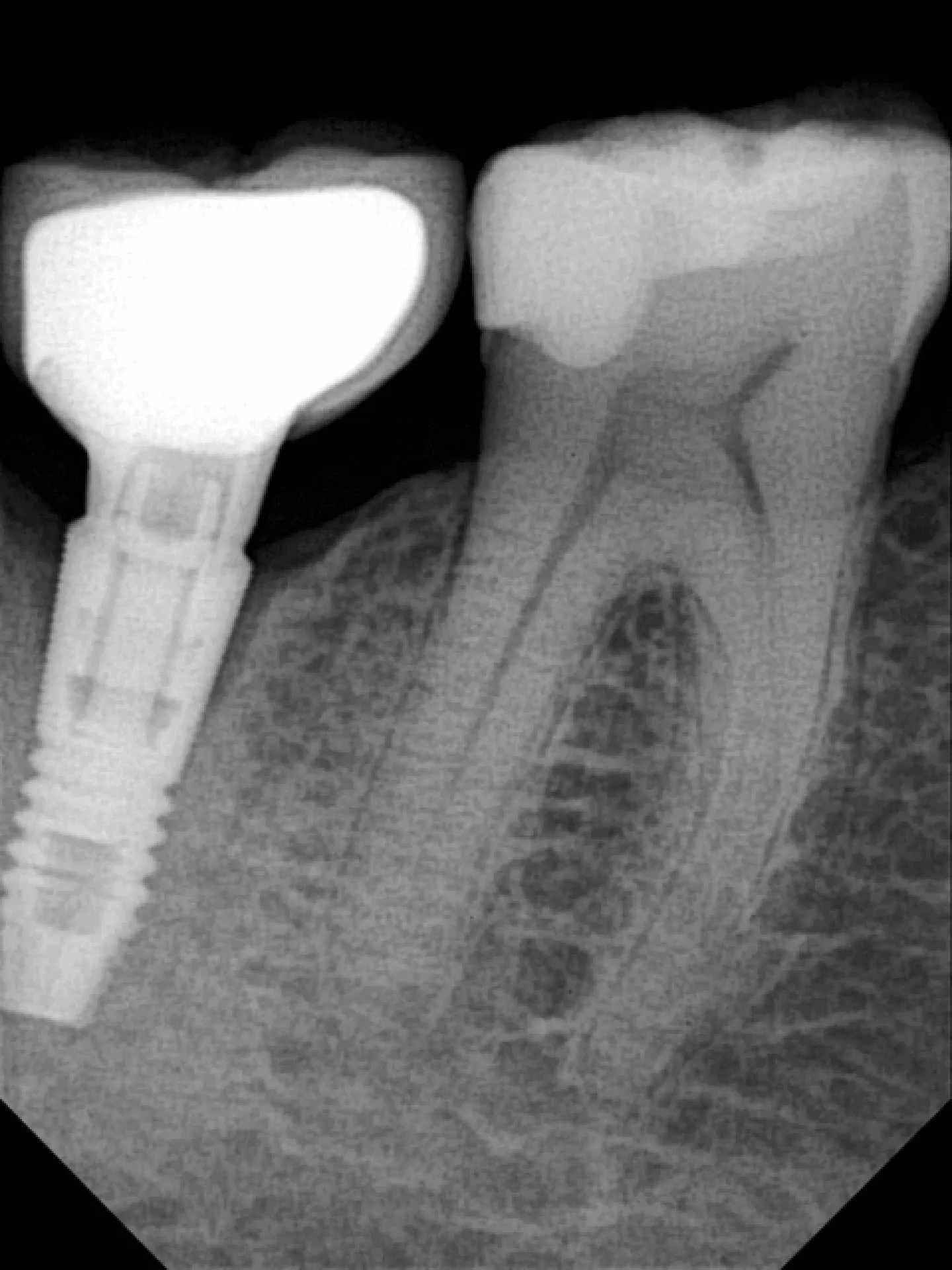 Owandy Opteo capteur intra-oral imagerie