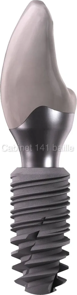 Implant Dentaire Prix Marseille.