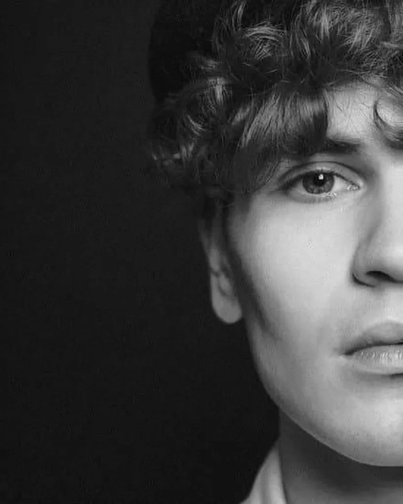 profhilo Structura Paris 