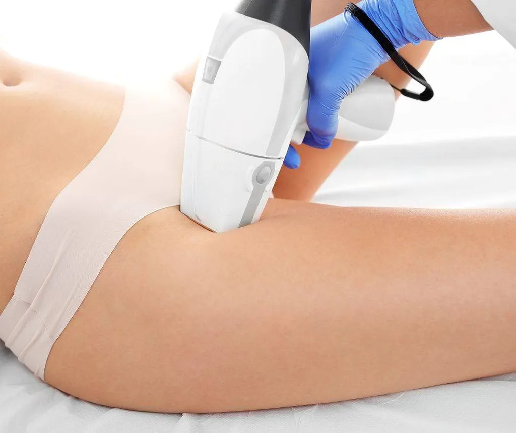 Séance d'épilation au laser pour le maillot intégral à Aubagne