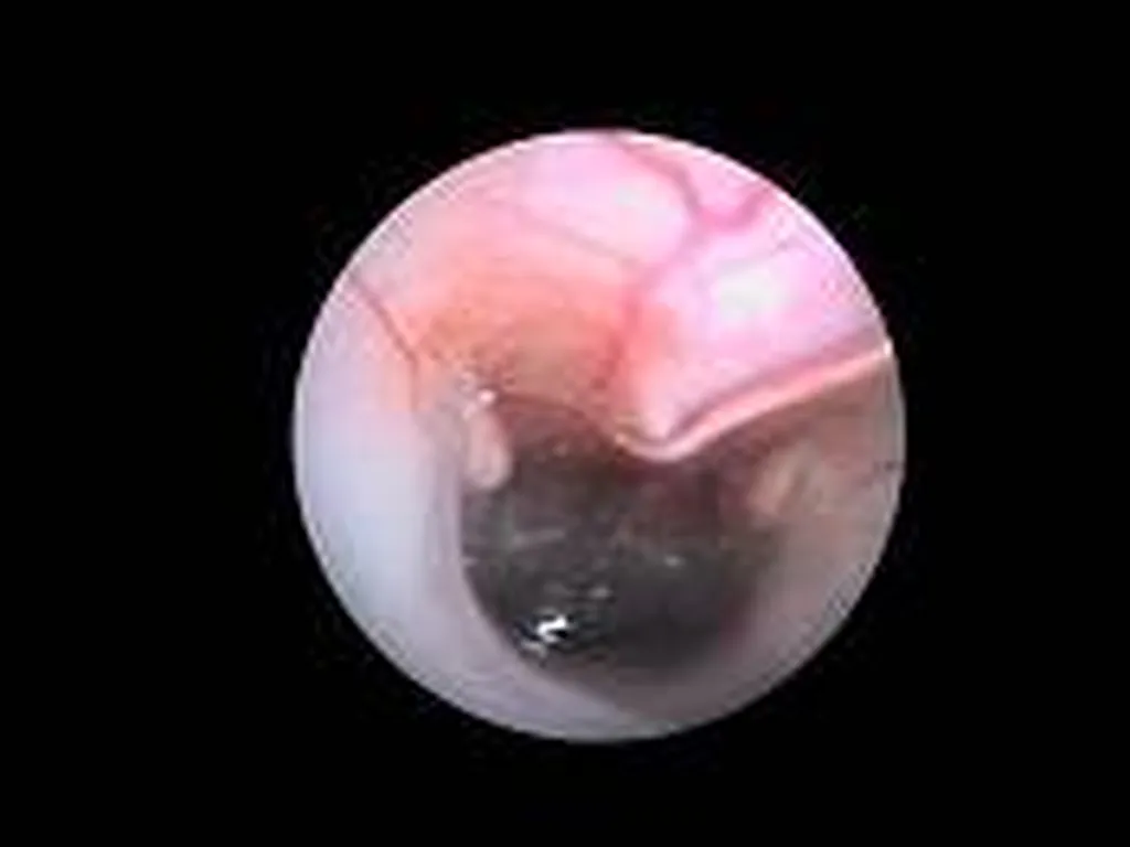 endoscopie chien Le Revest les eaux