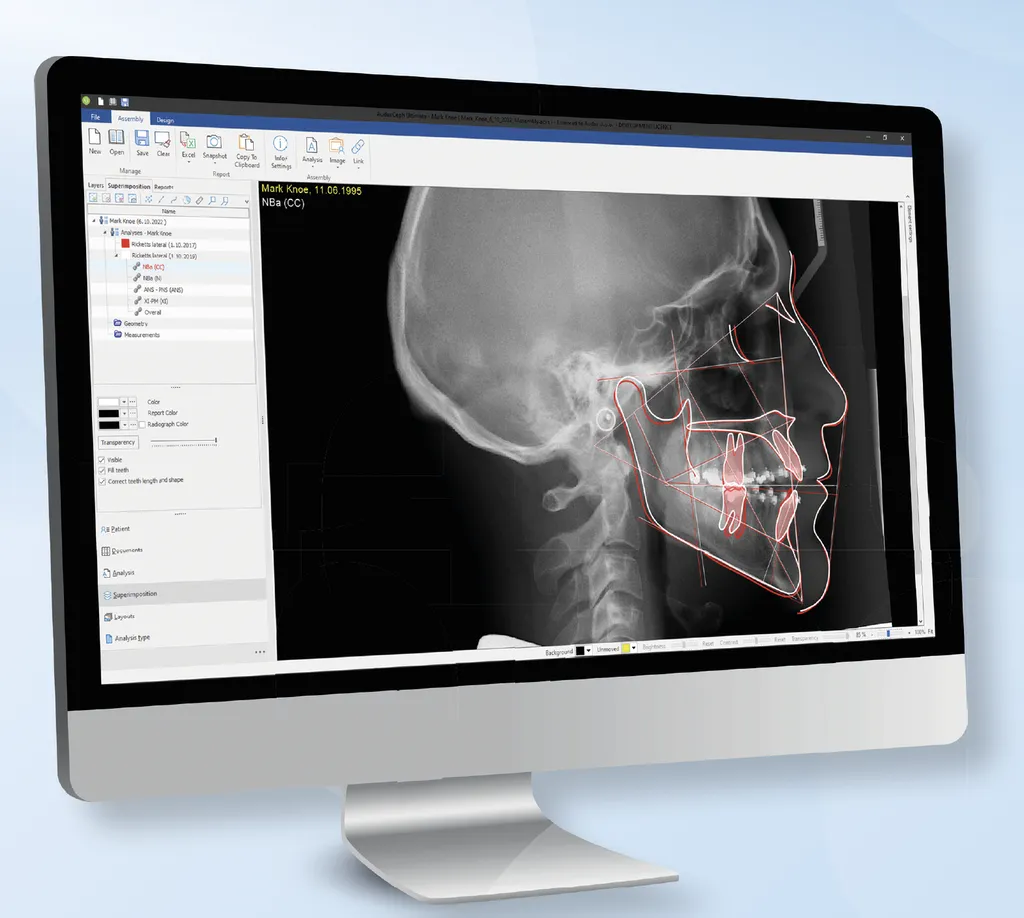 Owandy CEPH ANALYSIS Meditec Dental à Marseille 13