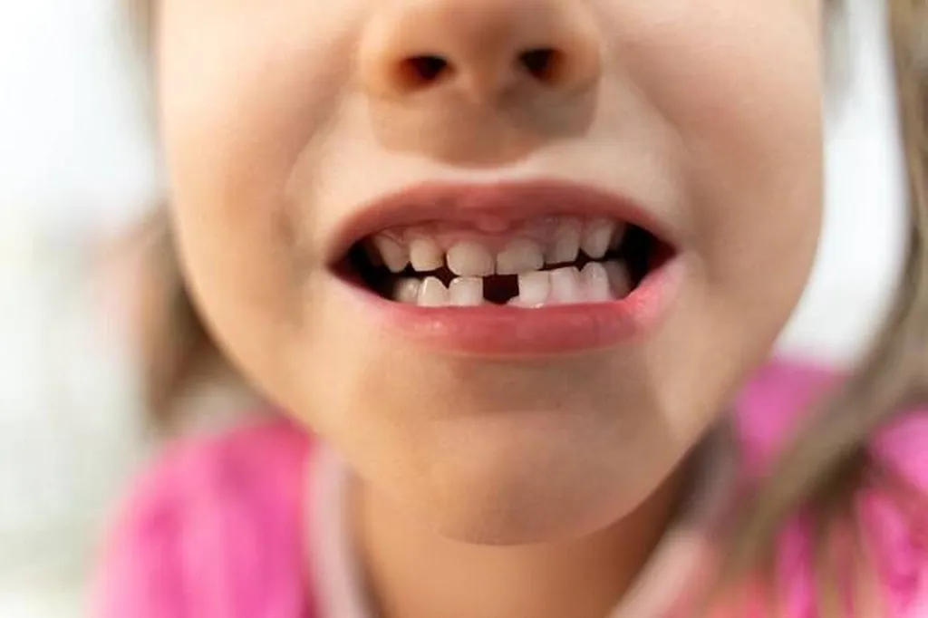 aller en confiance chez le dentiste avec sophrologie le havre