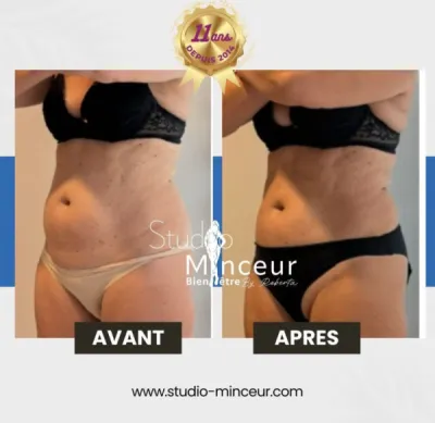 **AVANT/APRÈS QUI PARLE À
TOUTES**