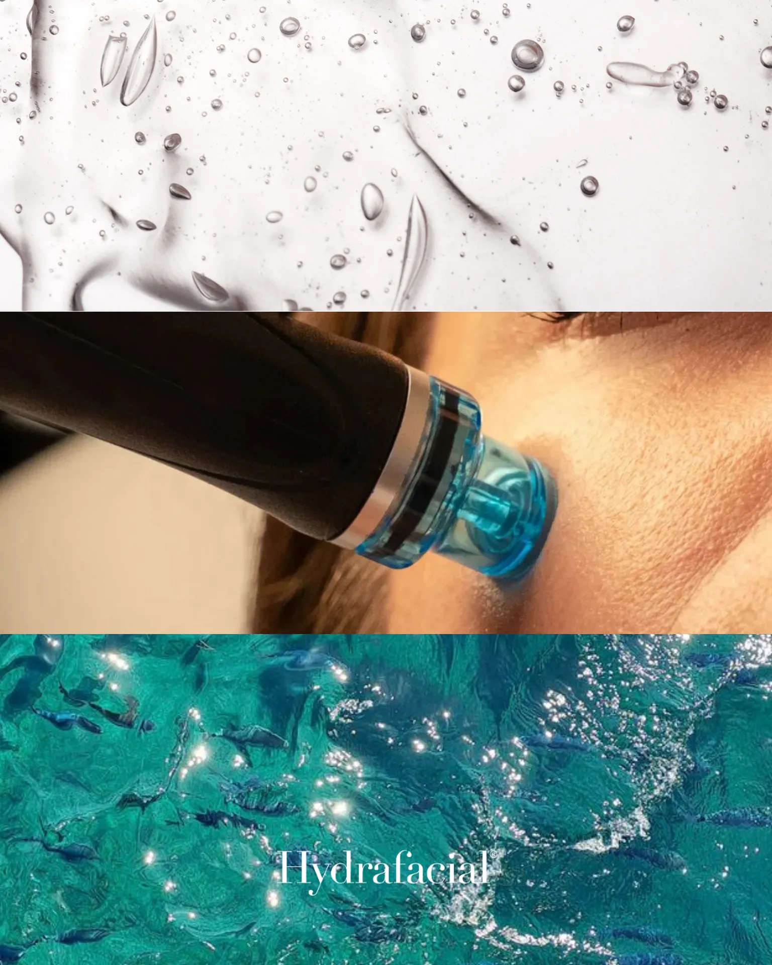 Hydrafacial à Toulouse 