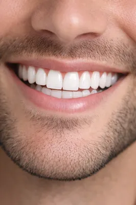 spécialiste chirurgie guidée implantologie dentaire 