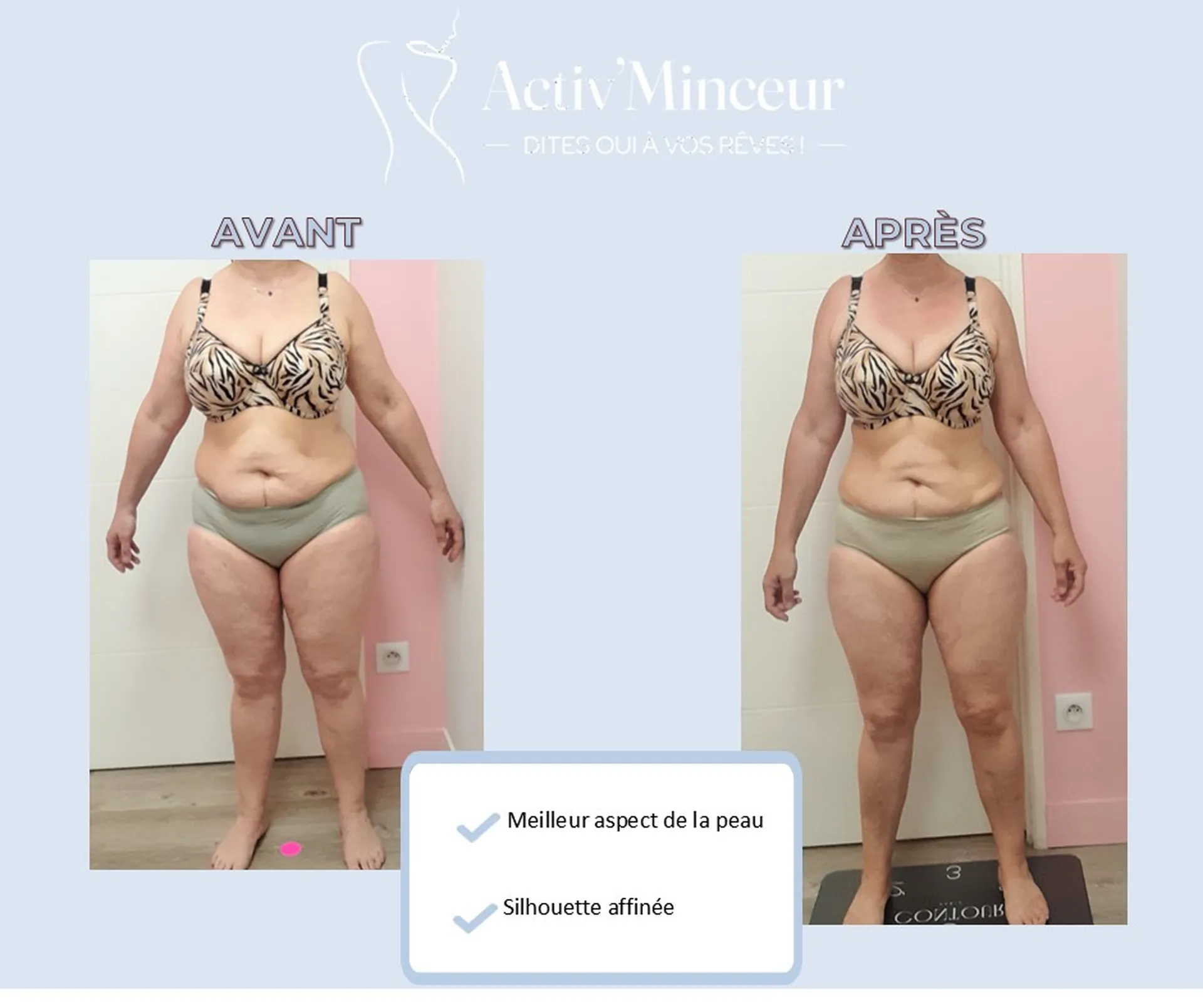 Marina   59 ans   -41 cm  -7.3 kg en 3 mois 