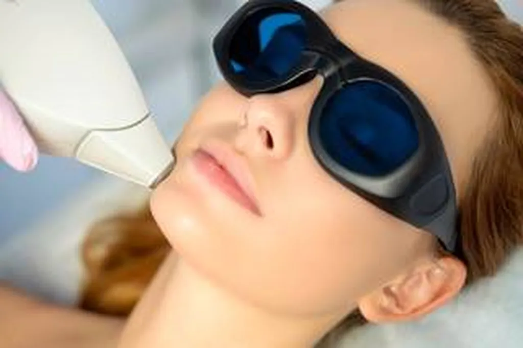 Les traitements par lasers, comment ca se passe ?