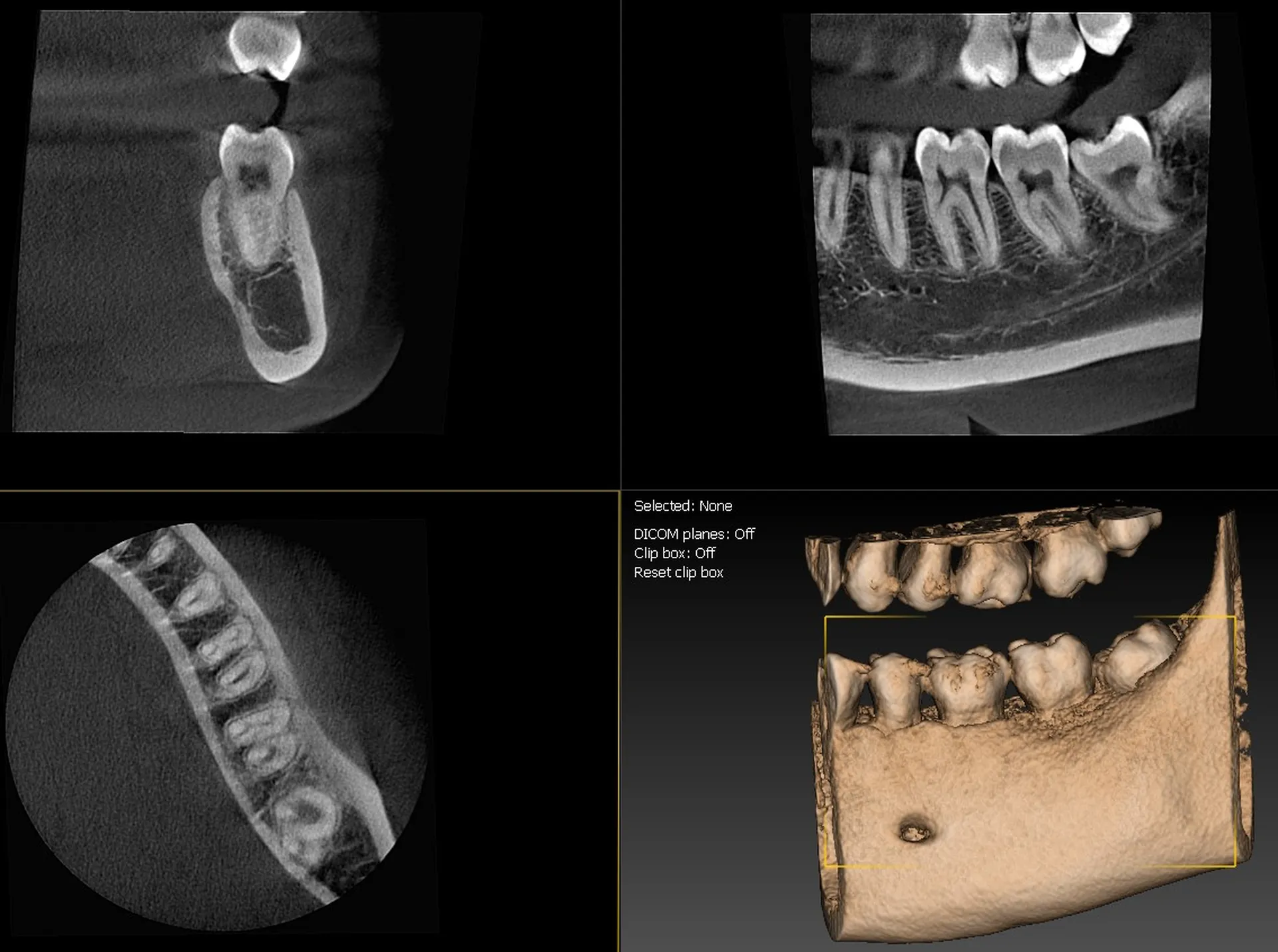 Meditec Dental Owandy iMax 3D XPRO Volume 5x5 à Marseille 13