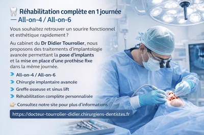 specialiste all on 4 et all on 6 dr Tourrolier didier
