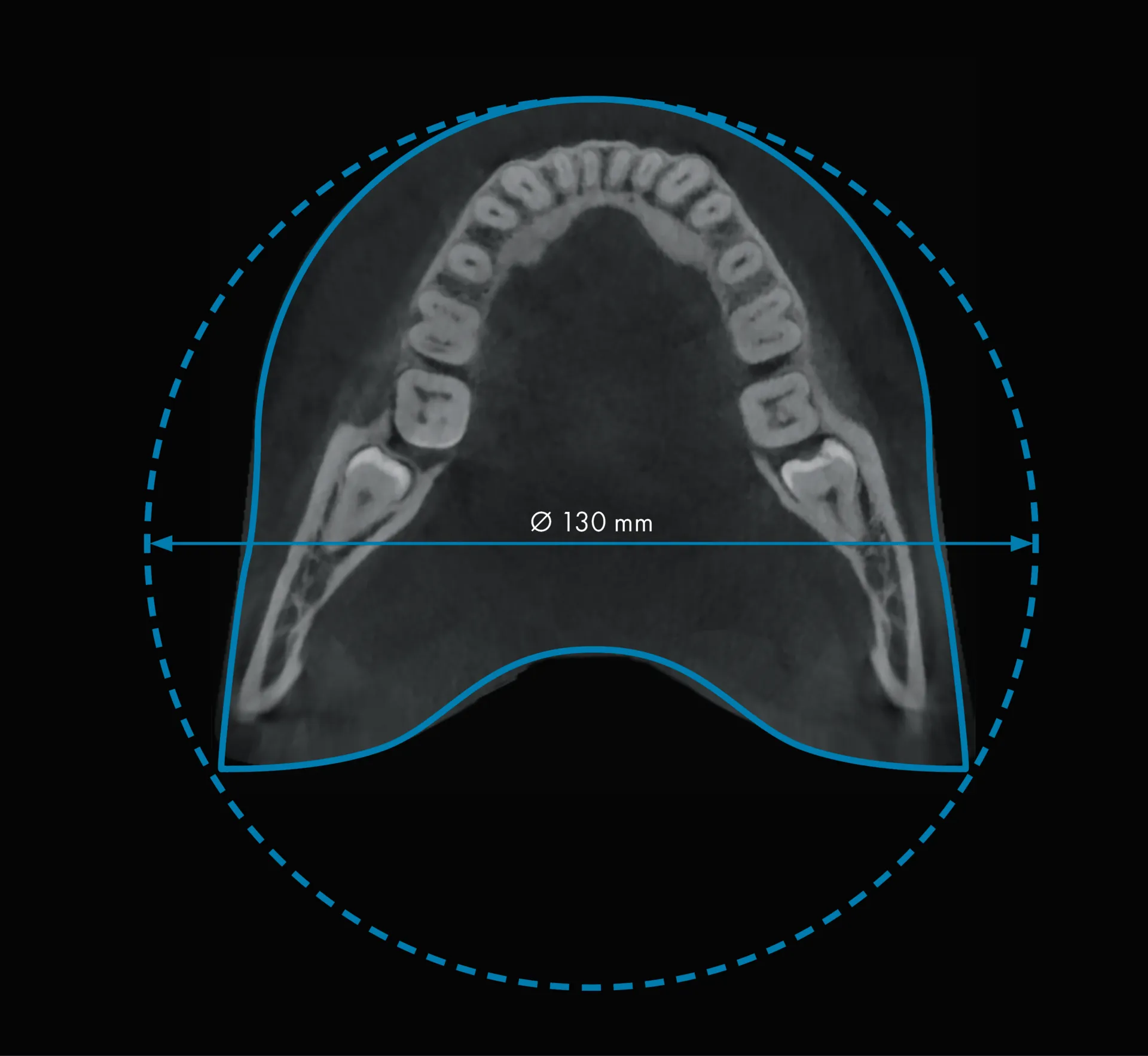 Durr Dental VistaVox S 130 x 80 