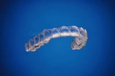 Orthodontie par Gouttière Invisible-Marseille