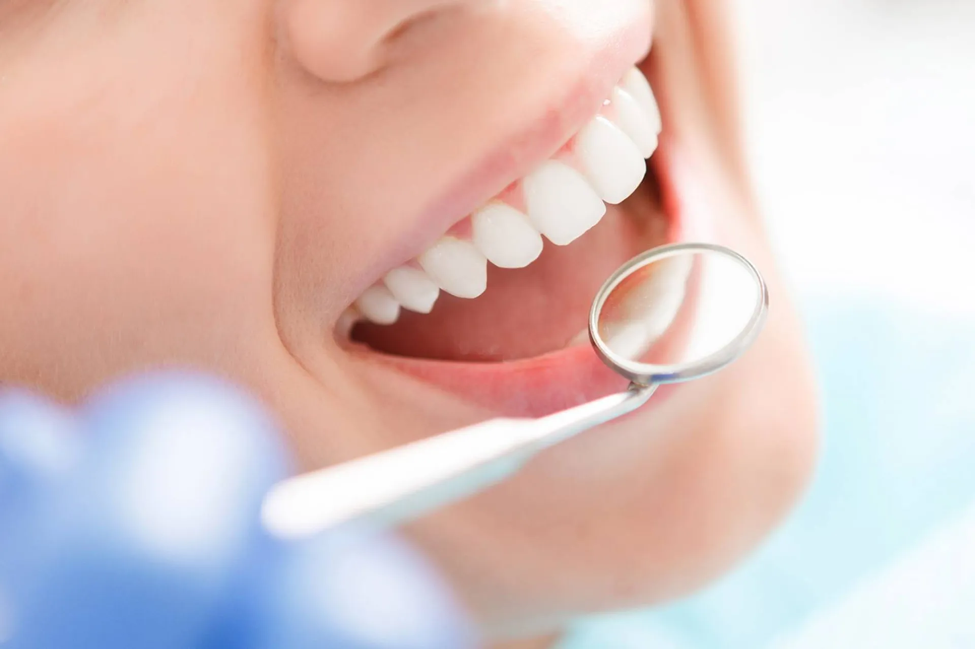 traitement invisalign cabinet dentaire marseille 13016